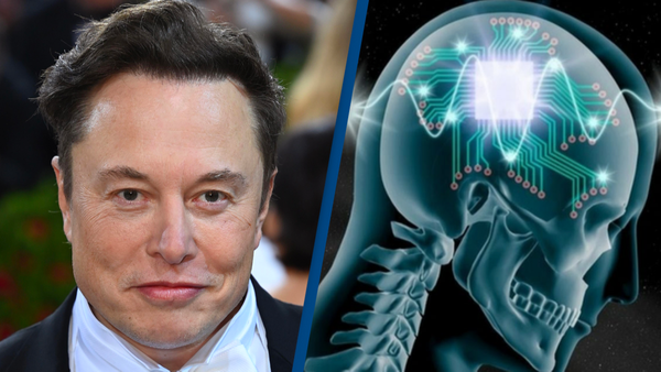 Elon Musk's Brain Chip Neuralink N1: A Step Closer to Human Implantation?